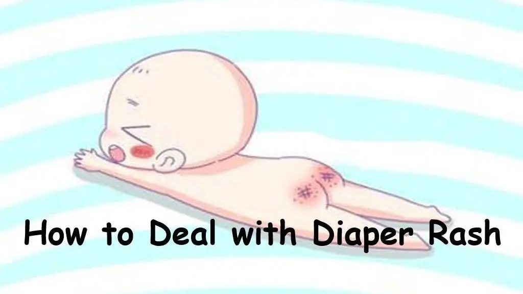 how-to-deal-with-diaper-rash-baby-product-insider