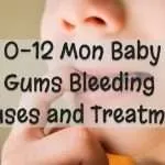 Baby Gums Bleeding