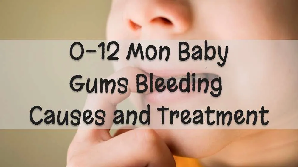 Baby Gums Bleeding