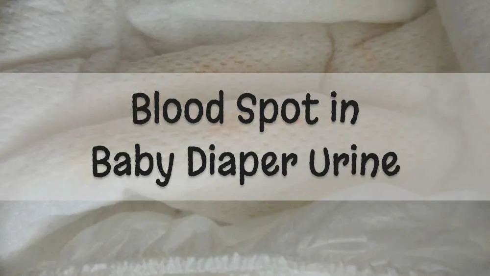 Blood Spot in Baby Diaper Urine