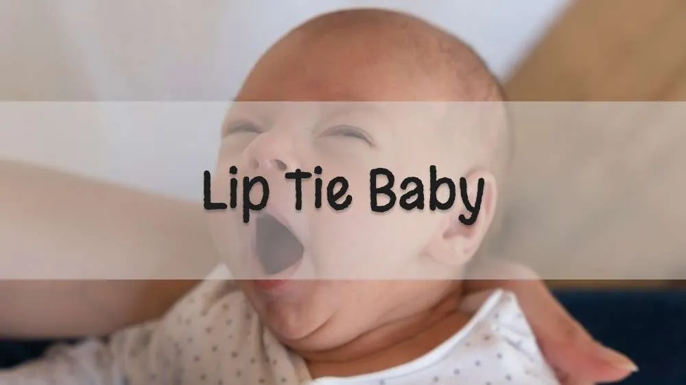 All You Need to Know About Lip Tie Baby