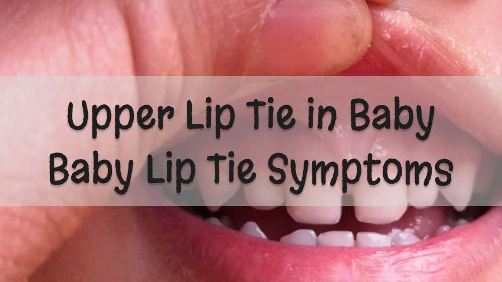 What is Upper Lip Tie in Baby: Baby Lip Tie Symptoms